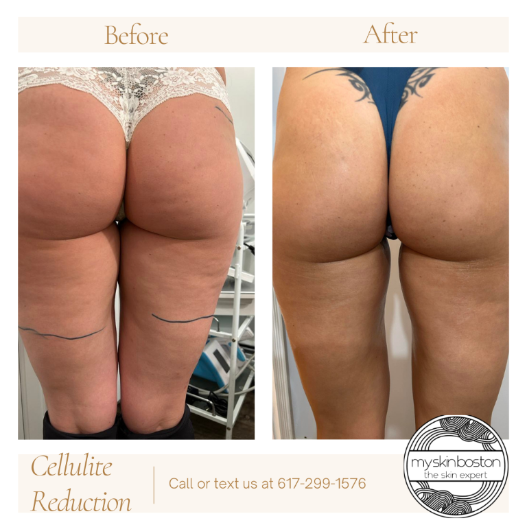 Skin Transformation Before and After